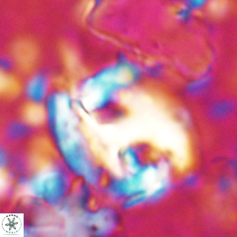 Helicosphaerella truncata VR 028840