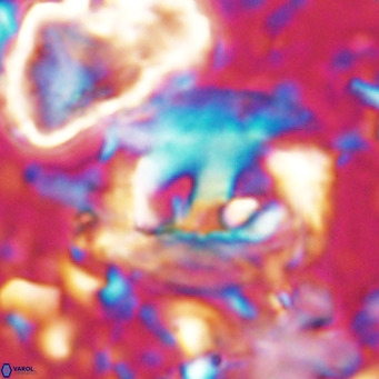Helicosphaerella truncata VR 028843