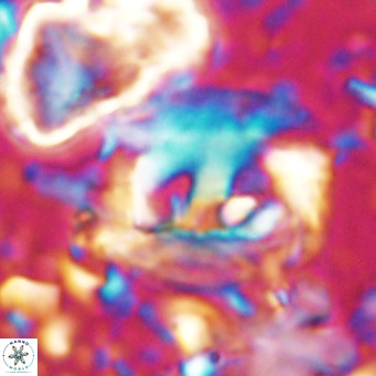 Helicosphaerella truncata VR 028843