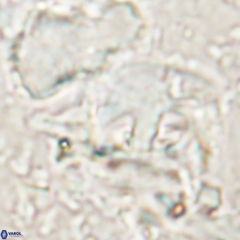 Helicosphaerella truncata VR 028844