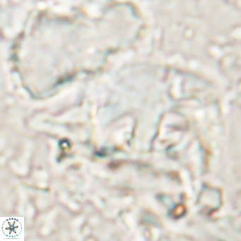 Helicosphaerella truncata VR 028844