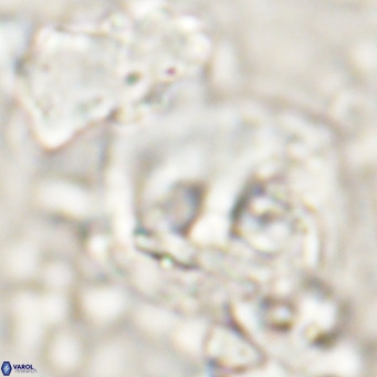 Helicosphaerella truncata VR 028845