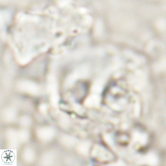 Helicosphaerella truncata VR 028845