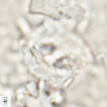 Helicosphaerella truncata VR 028847