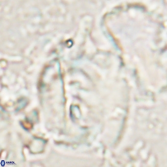 Helicosphaerella truncata VR 028848