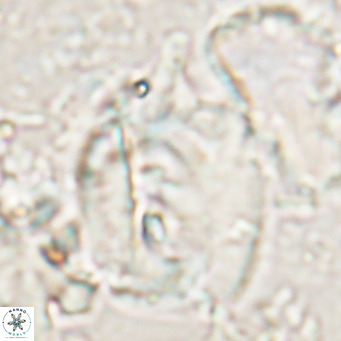 Helicosphaerella truncata VR 028848