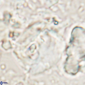 Helicosphaerella truncata VR 028849