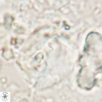 Helicosphaerella truncata VR 028849