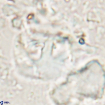 Helicosphaerella truncata VR 028851