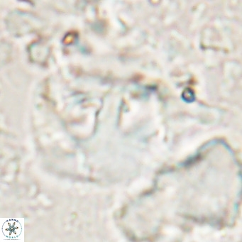 Helicosphaerella truncata VR 028851