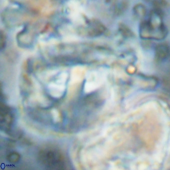 Helicosphaerella truncata VR 028852