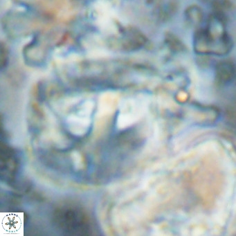 Helicosphaerella truncata VR 028852