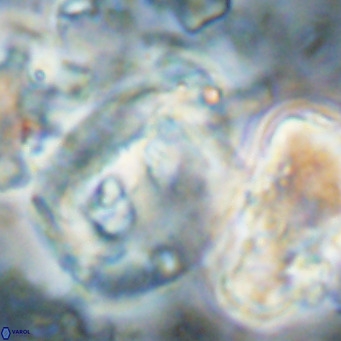 Helicosphaerella truncata VR 028853