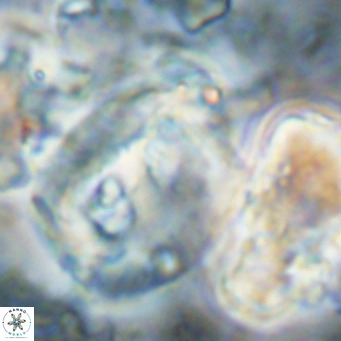 Helicosphaerella truncata VR 028853