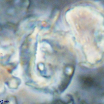 Helicosphaerella truncata VR 028854