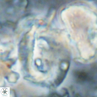 Helicosphaerella truncata VR 028854
