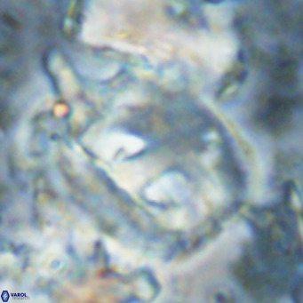 Helicosphaerella truncata VR 028856