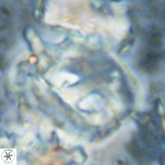 Helicosphaerella truncata VR 028856