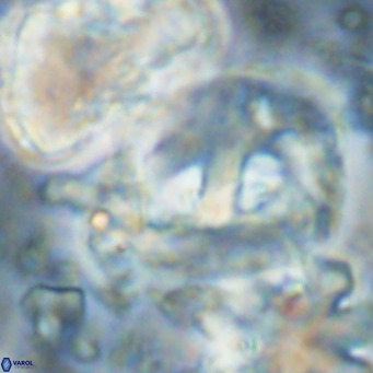 Helicosphaerella truncata VR 028857