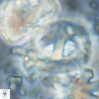 Helicosphaerella truncata VR 028857