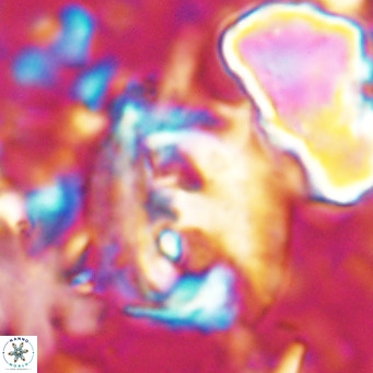 Helicosphaerella truncata VR 028834