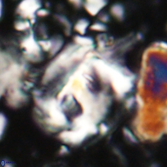 Helicosphaerella truncata VR 028837