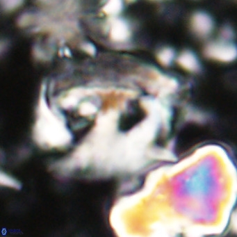 Helicosphaerella truncata VR 028838