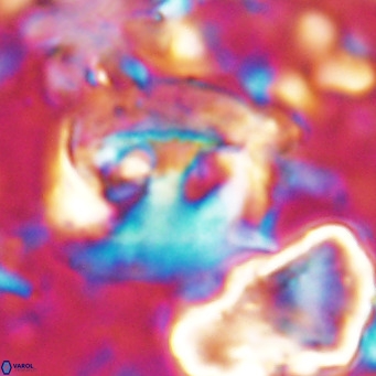 Helicosphaerella truncata VR 028839