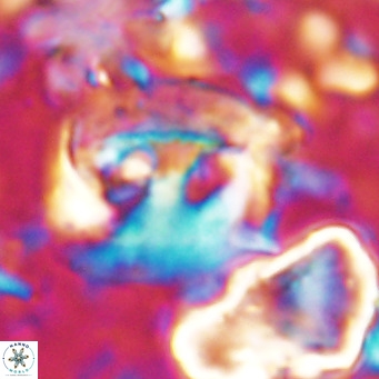 Helicosphaerella truncata VR 028839