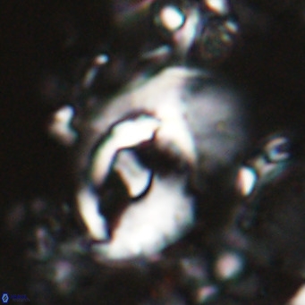 Helicosphaerella wilcoxonii VR 024454