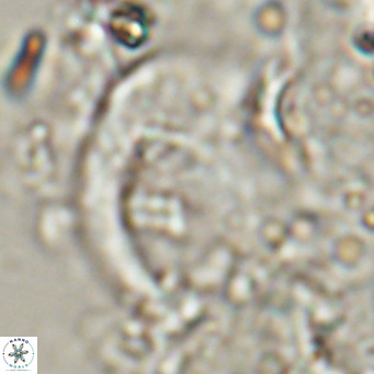 Helicosphaerella wilcoxonii VR 024457