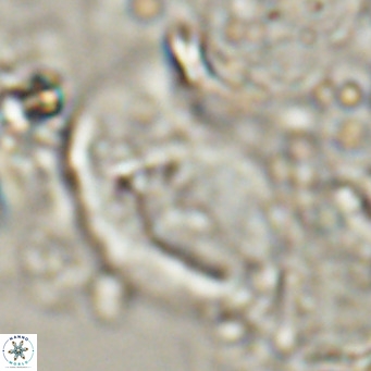 Helicosphaerella wilcoxonii VR 024458