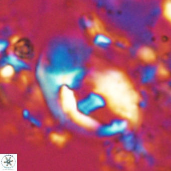 Helicosphaerella wilcoxonii VR 024452