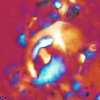 Helicosphaerella wilcoxonii VR 024453
