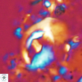 Helicosphaerella wilcoxonii VR 024453