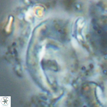 Helicosphaerella wilcoxonii VR 024464