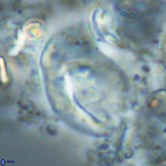 Helicosphaerella wilcoxonii VR 024465
