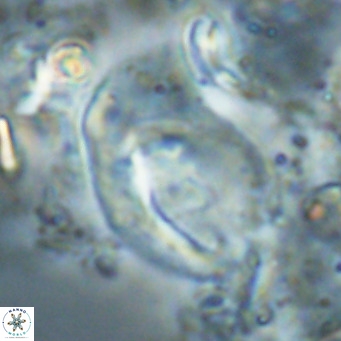 Helicosphaerella wilcoxonii VR 024465
