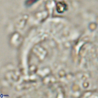 Helicosphaerella wilcoxonii VR 024461