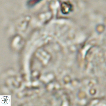Helicosphaerella wilcoxonii VR 024461