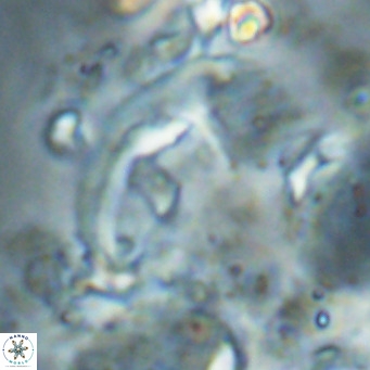 Helicosphaerella wilcoxonii VR 024462