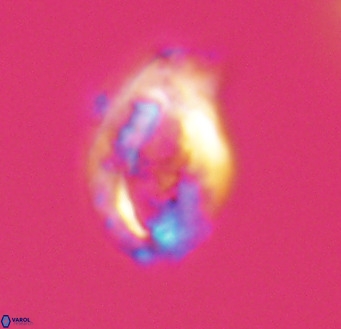 Helicosphaerella wilcoxonii VR 32358