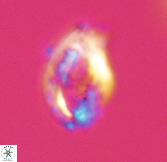 Helicosphaerella wilcoxonii VR 32358