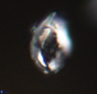 Helicosphaerella wilcoxonii VR 32359