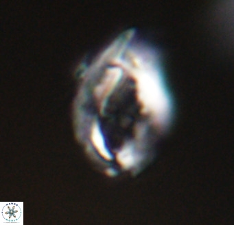 Helicosphaerella wilcoxonii VR 32359