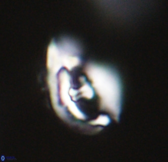 Helicosphaerella wilcoxonii VR 32360