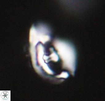 Helicosphaerella wilcoxonii VR 32360