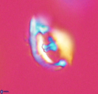 Helicosphaerella wilcoxonii VR 32361