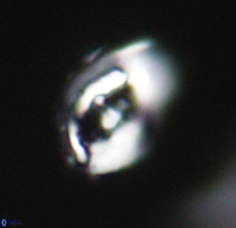 Helicosphaerella wilcoxonii VR 32364