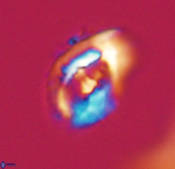 Helicosphaerella wilcoxonii VR 32365